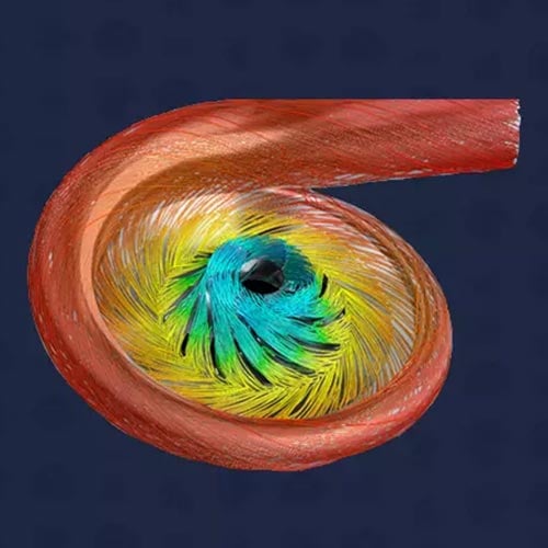 Toolkits--Optimize-Volutes